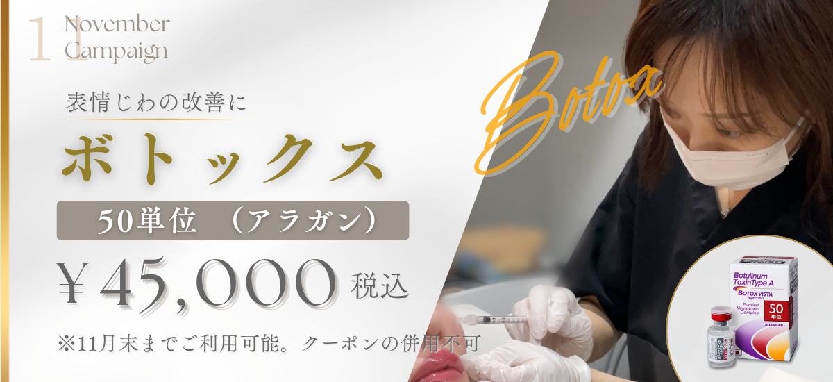 ボトックス50単位打ち放題