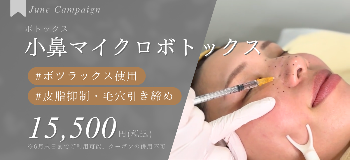 小鼻マイクロボトックス| 月次キャンペーン