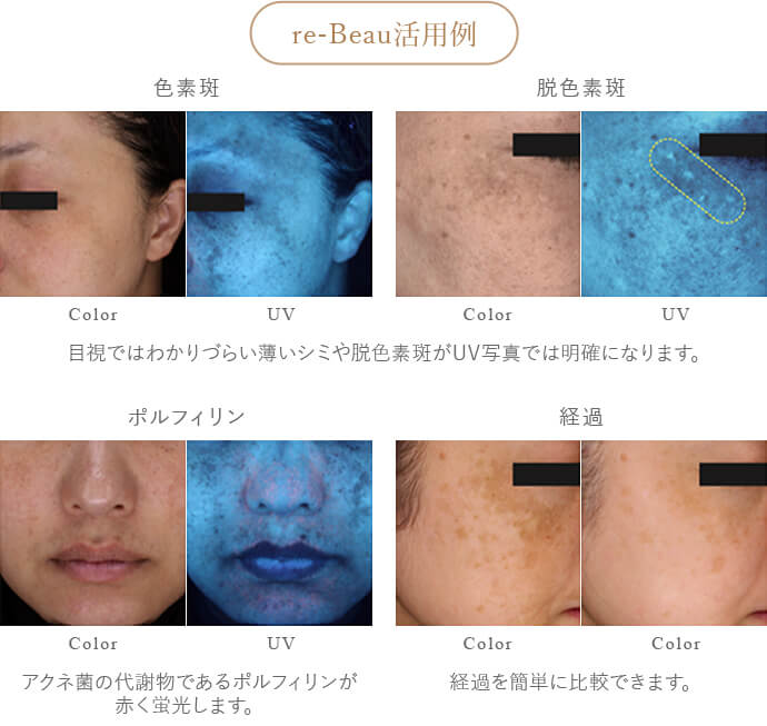 re-Beau活用例